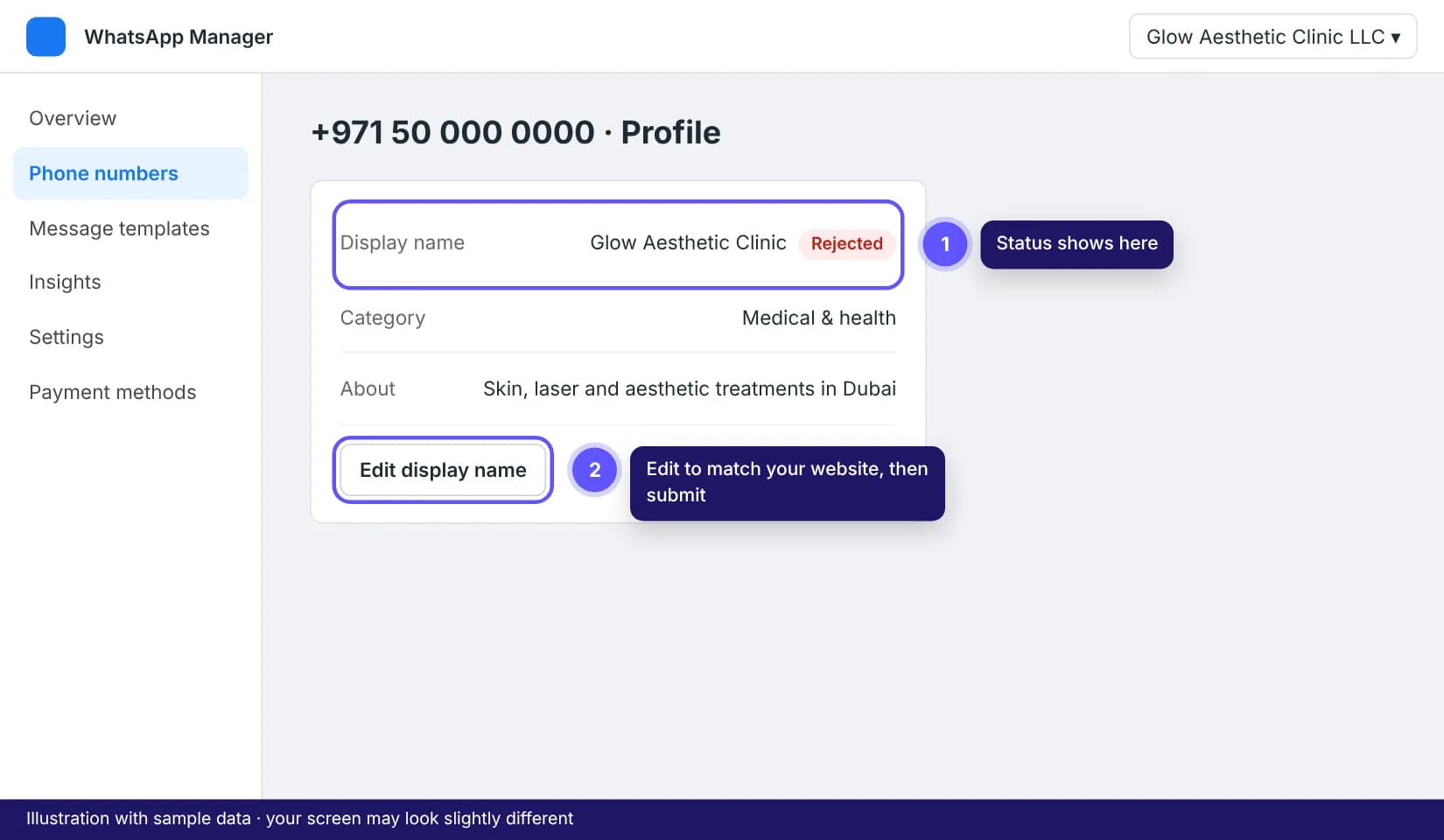 Phone number profile in WhatsApp Manager with the display name and edit option